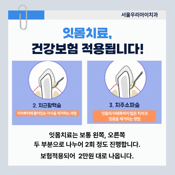 광주 잇몸치료 만원에 지키는 치아건강 선택이 아니라 필수입니다