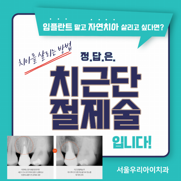 시술 전