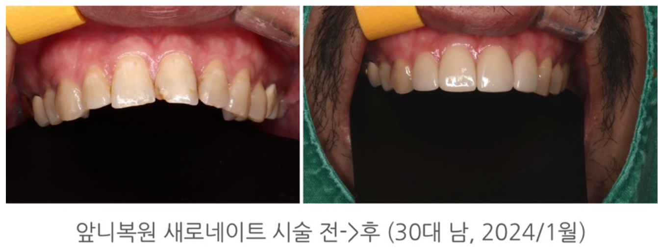 잦은 음주와 흡연이 일상이라면 30대 이상 남성분들 후회하지 않...