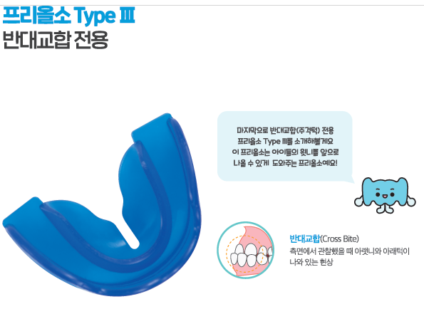 광주 소아 교정치과를 추천해주세요. 거꾸로 물리는 소아 부정교합...