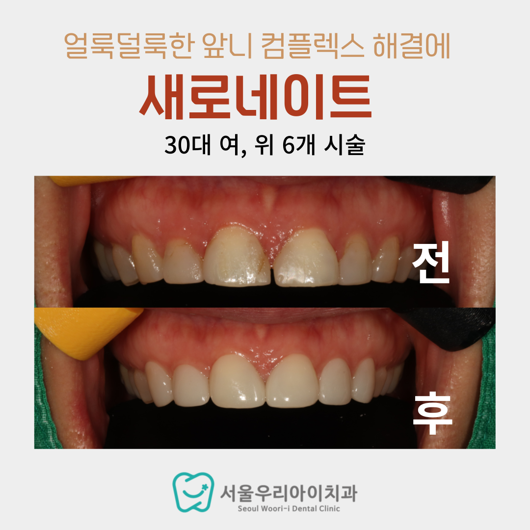 광주 라미네이트에 자신있는 이유는 바로 이것 입니다!