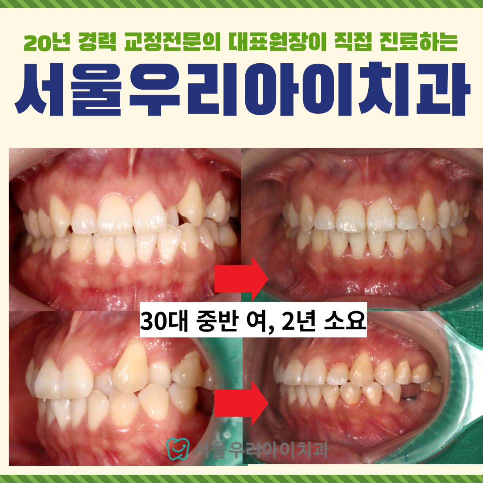광주 치아교정 경험많은 교정전문의가 진료하는 곳을 찾으신다면?