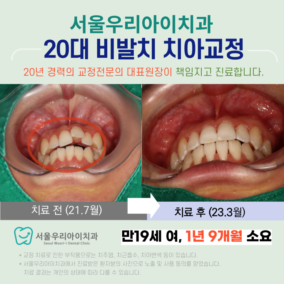 광주교정치과 20대 치아교정 경험많은 교정전문의 대표원장 진료하...