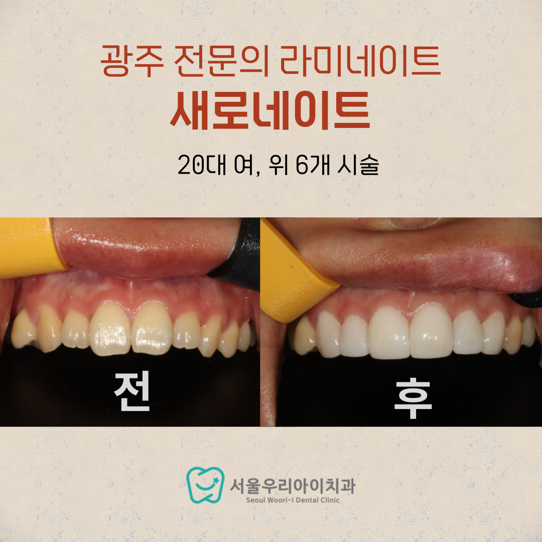 광주 라미네이트 제로네이트 미니쉬 블랙필름과의 차이점은