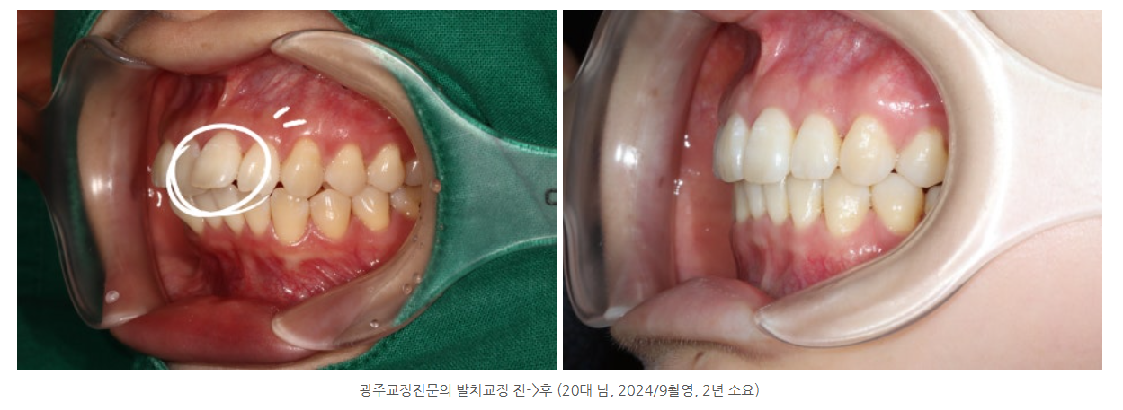 광주광역시에서 교정전문의가 있는 치과는 어디인가요?