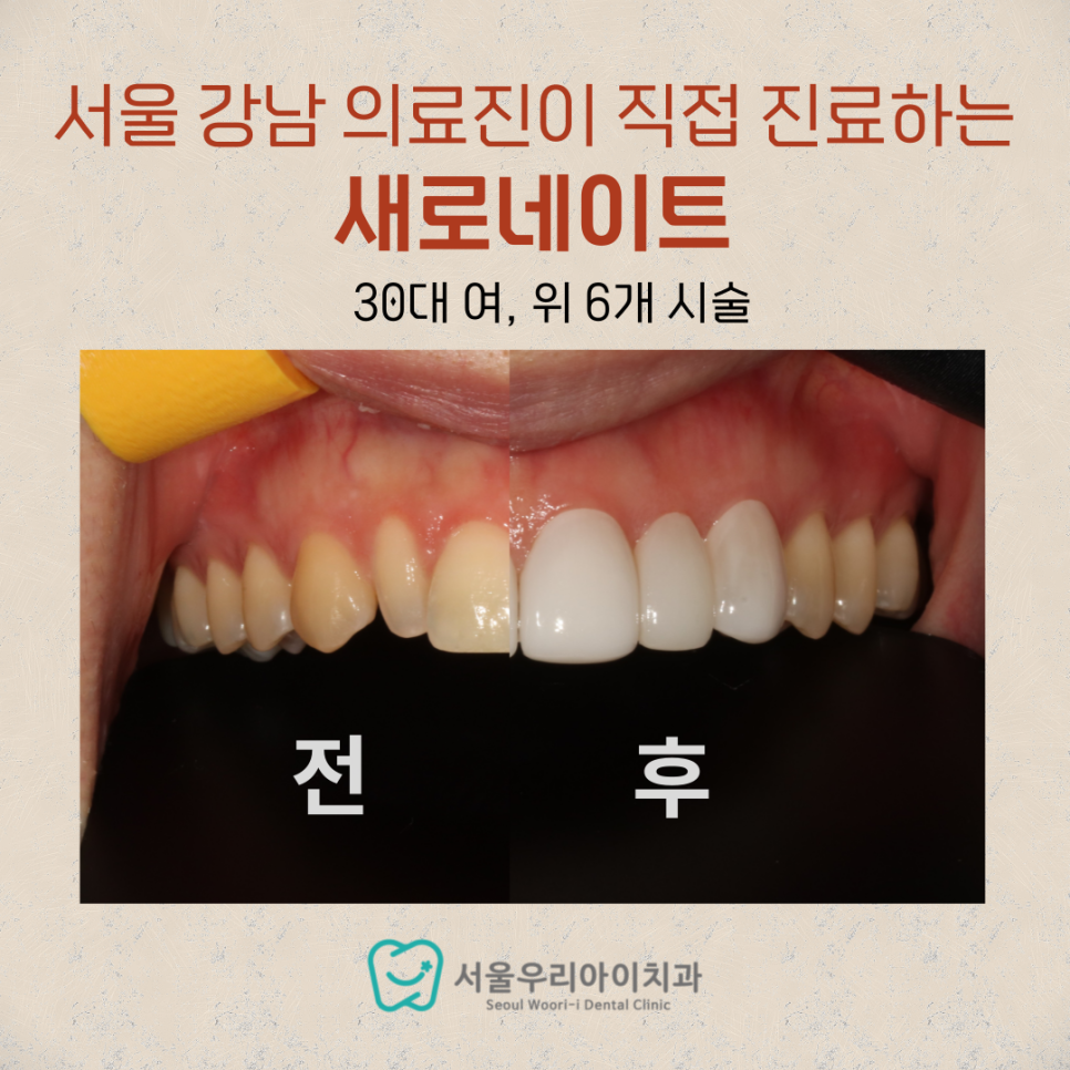 광주 왜소치 때문에 고민이라면 해결방법은?