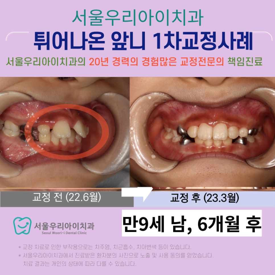 광산구교정치과 광주교정전문의가 진료하는 곳이 어디일까요?